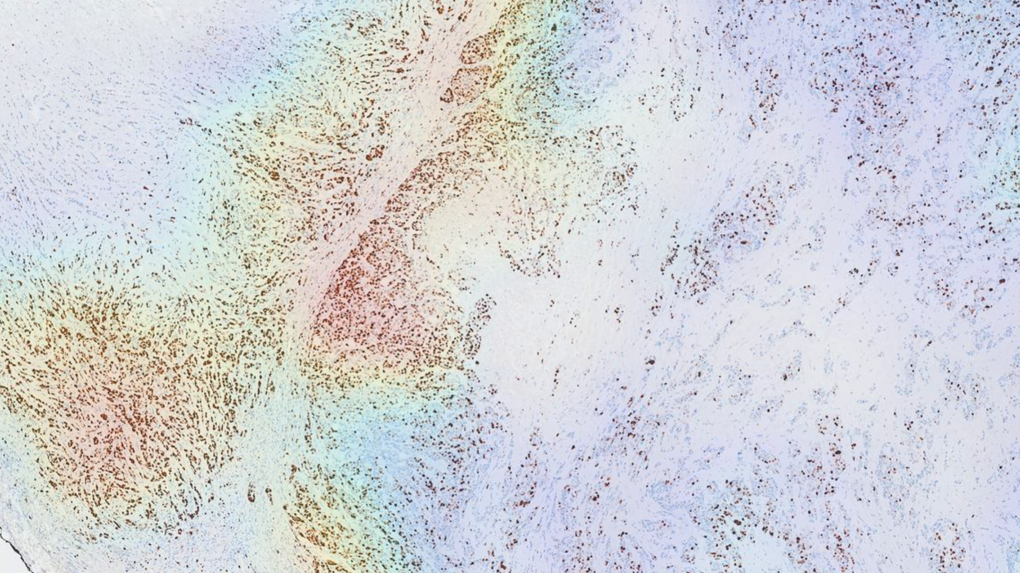 /images/qanti-IHC/Hotspot Visualization.png